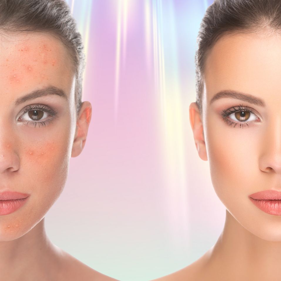 Crystal Light Facial