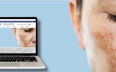 Causes of Skin Pigmentation